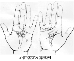 王大有手相实例